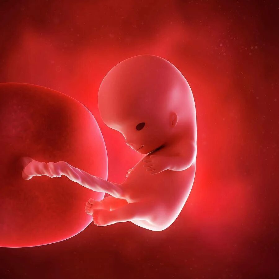Первая акушерская неделя. Эмбрион на 10 неделе беременности. 10 Недель беременности фото плода. Плод 9-10 акушерских недель беременности. Зародыш человека 9-10 недель.