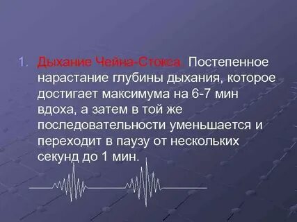 Чейн стокс