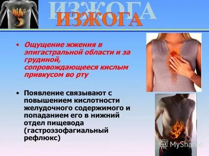 Жжение в грудине причины лечение