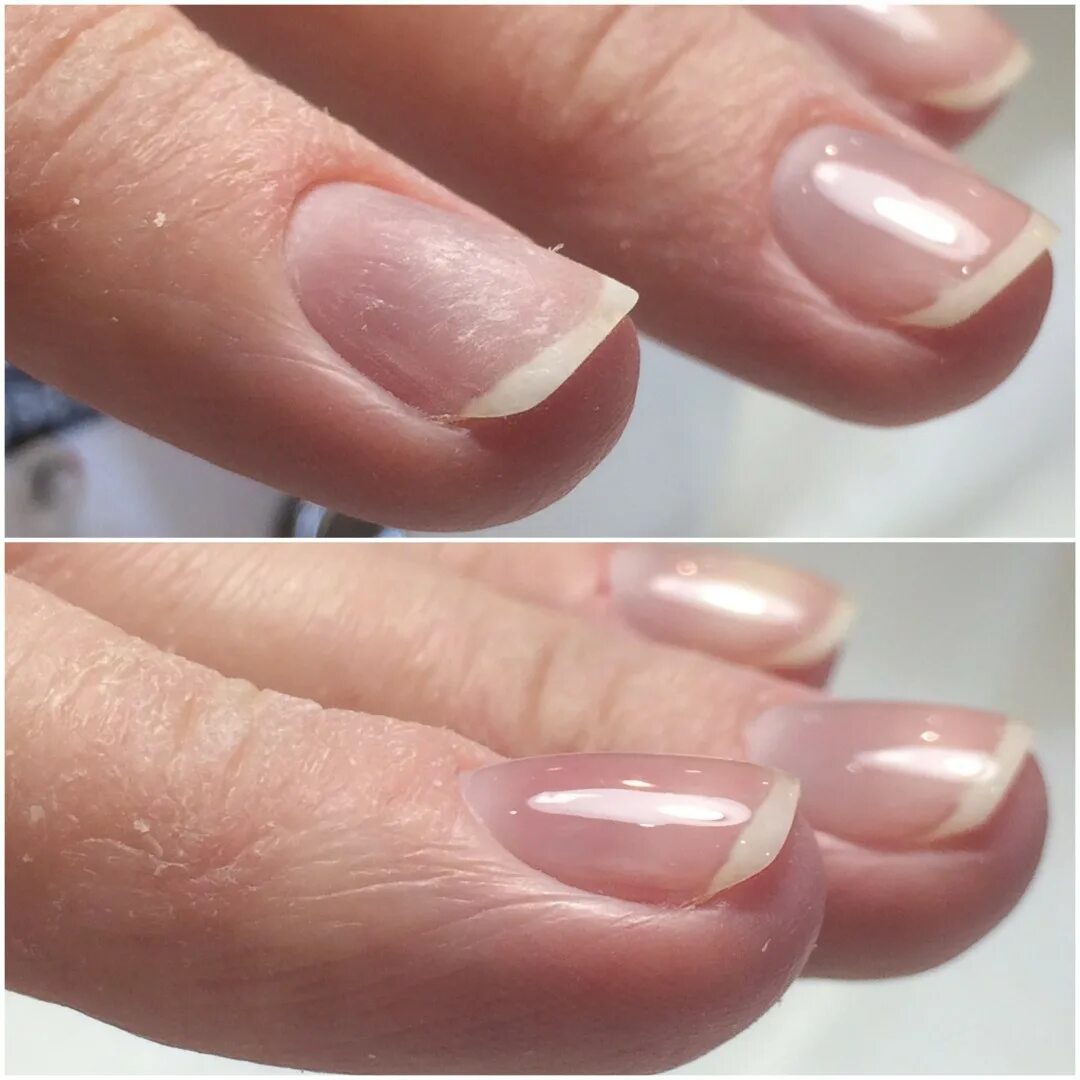 Выравнивание ногтевой пластины базой. Выравнивание ногтевой пластины гелем. Укрепление ногтей. Ровные ногти. Как выровнять ногти на руках.