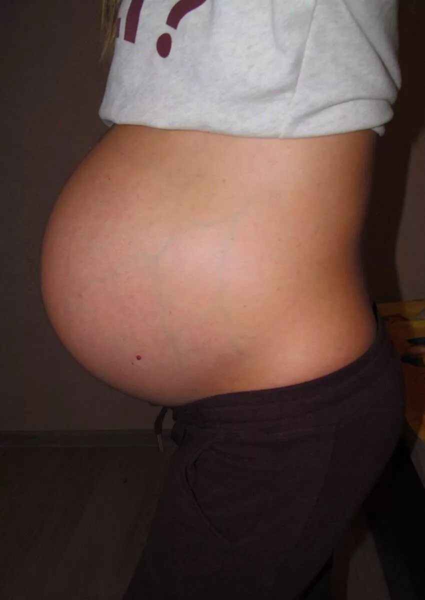 Живот на 20 неделе беременности. Животик на 20 неделе беременности. Живот на 19 неделе беременности. Живот на 18 неделе беременности. 18 неделя близнецов