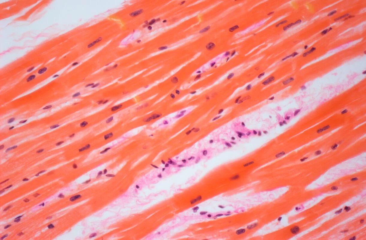 Поперечно полосатая сердечная мышечная ткань микропрепарат. Гладкая мышечная микропрепарат. Скелетная мышечная ткань микропрепарат. Сердечная мышечная ткань микропрепарат.