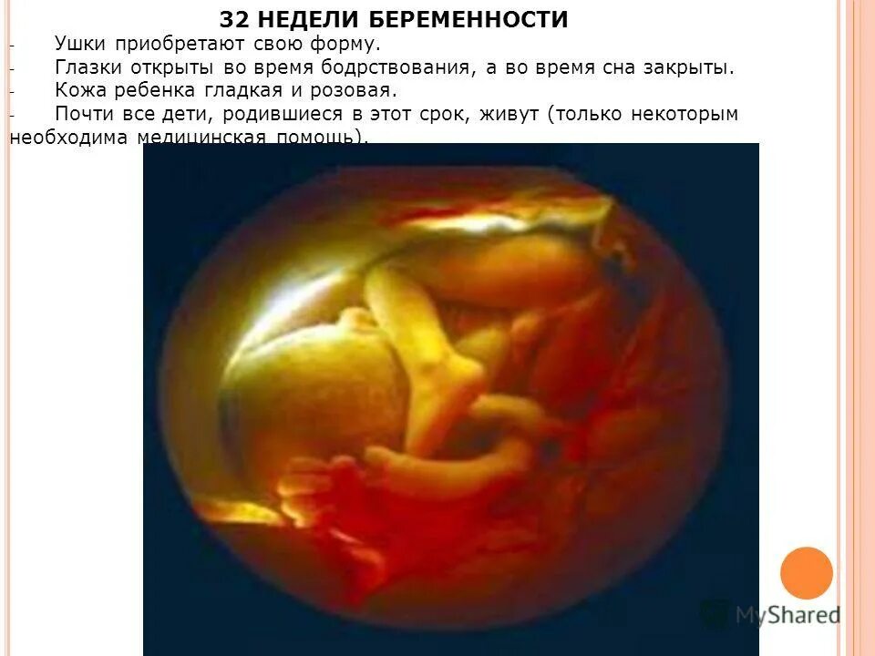 узи для беременных 32 недели беременности. беременность 32 недели развитие. плод на 32 неделе беременности. узи плода на 32 неделе беременности. узи на 32 неделе беременности показатели.