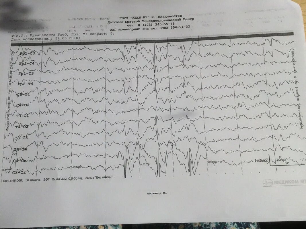 Ээг владивосток. Усилитель Nicone ЭЭГ. ЭКГ И ЭЭГ. ЭЭГ мониторинг сна. Задержка речевого развития на ЭЭГ.