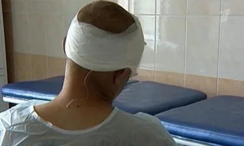 Больница голова