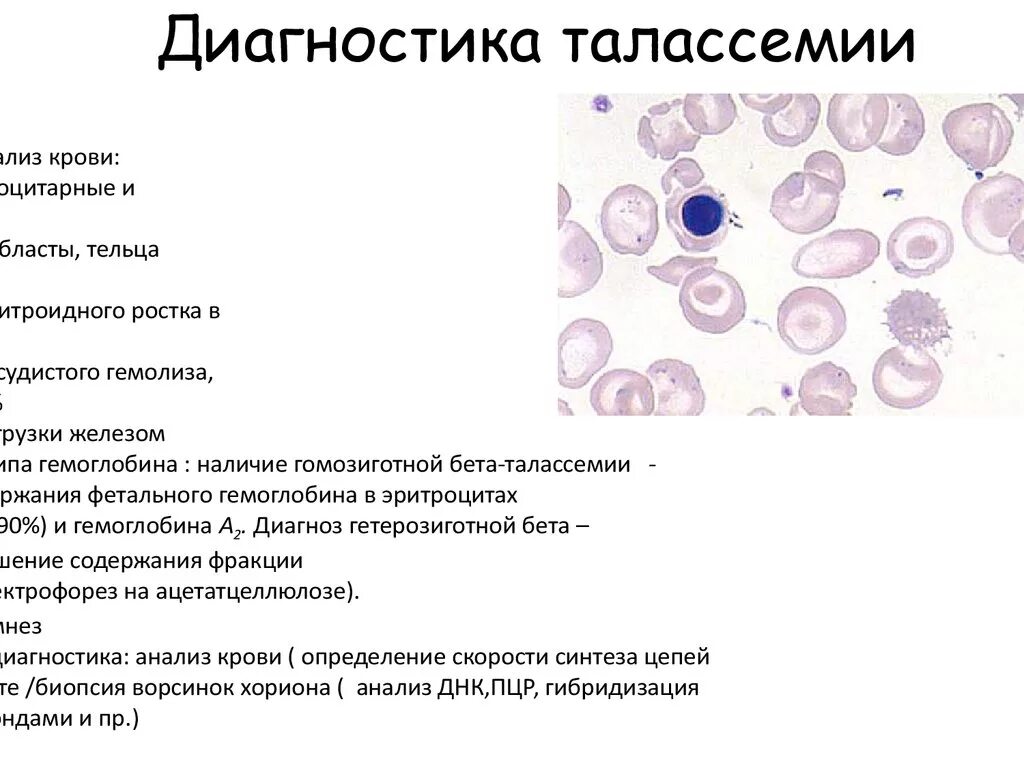 Синдром тельца. Картина крови при талассемии. Признаки талассемии лабораторные. Альфа талассемия картина крови. Диагностические критерии талассемии.