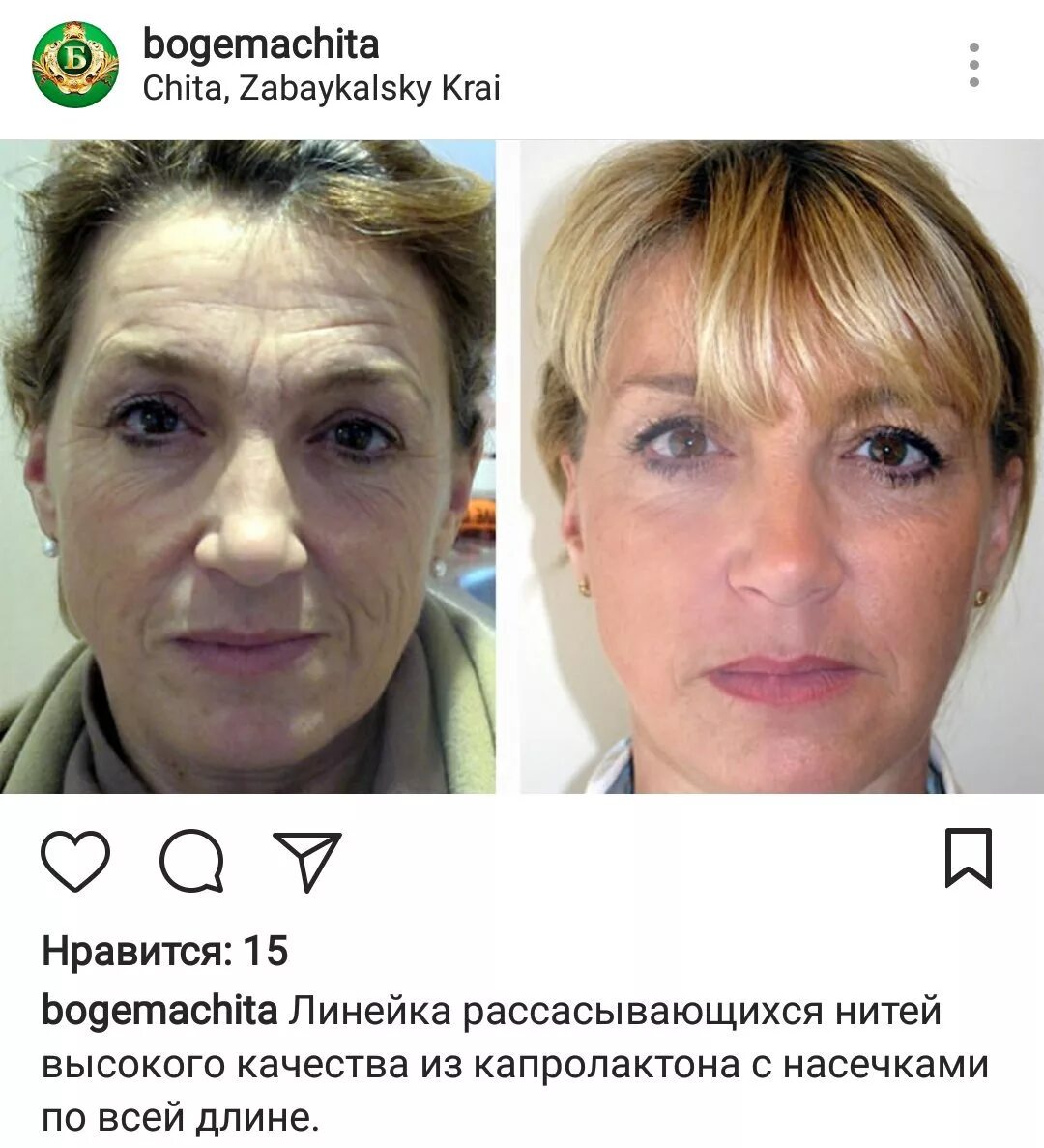 Нития отзывы пациентов