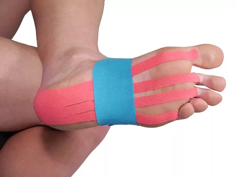 тейпирование при вальгусной деформации стопы у детей. тейпирование плосковальгусной стопы. тейпирование пальца при вальгусной деформации. тейпирование при вальгусной деформации. тейпирование пальца при вальгусной деформации.