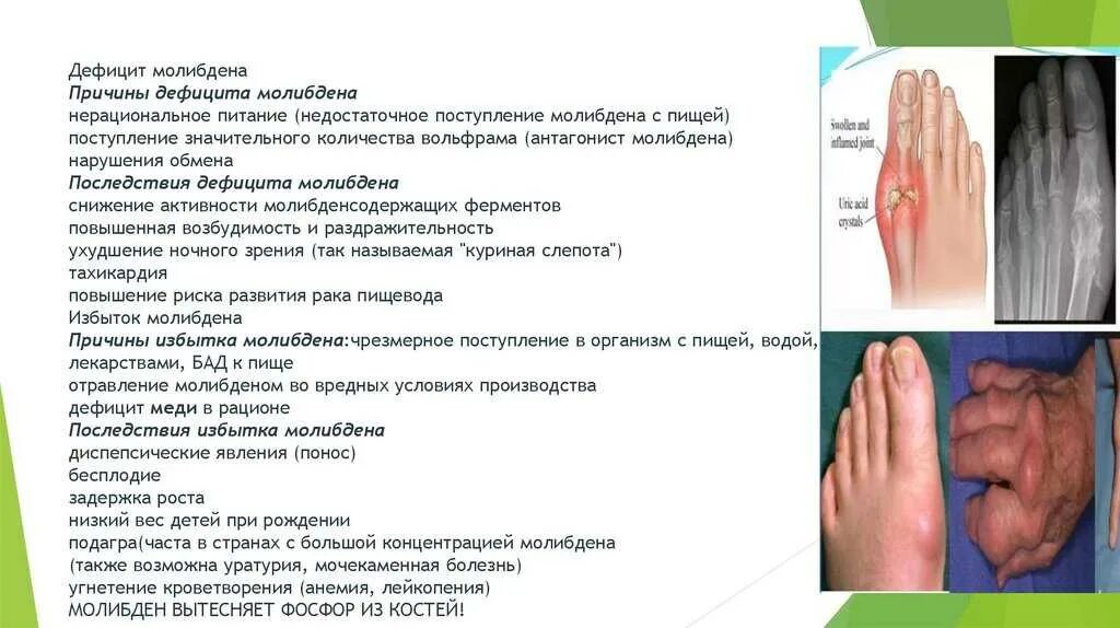 Чем грозит недостаток. Признаки нехватки элемента молибдена. Молибден заболевания при недостатке. Болезни при недостатке молибдена. Недостаток молибдена в организме человека.