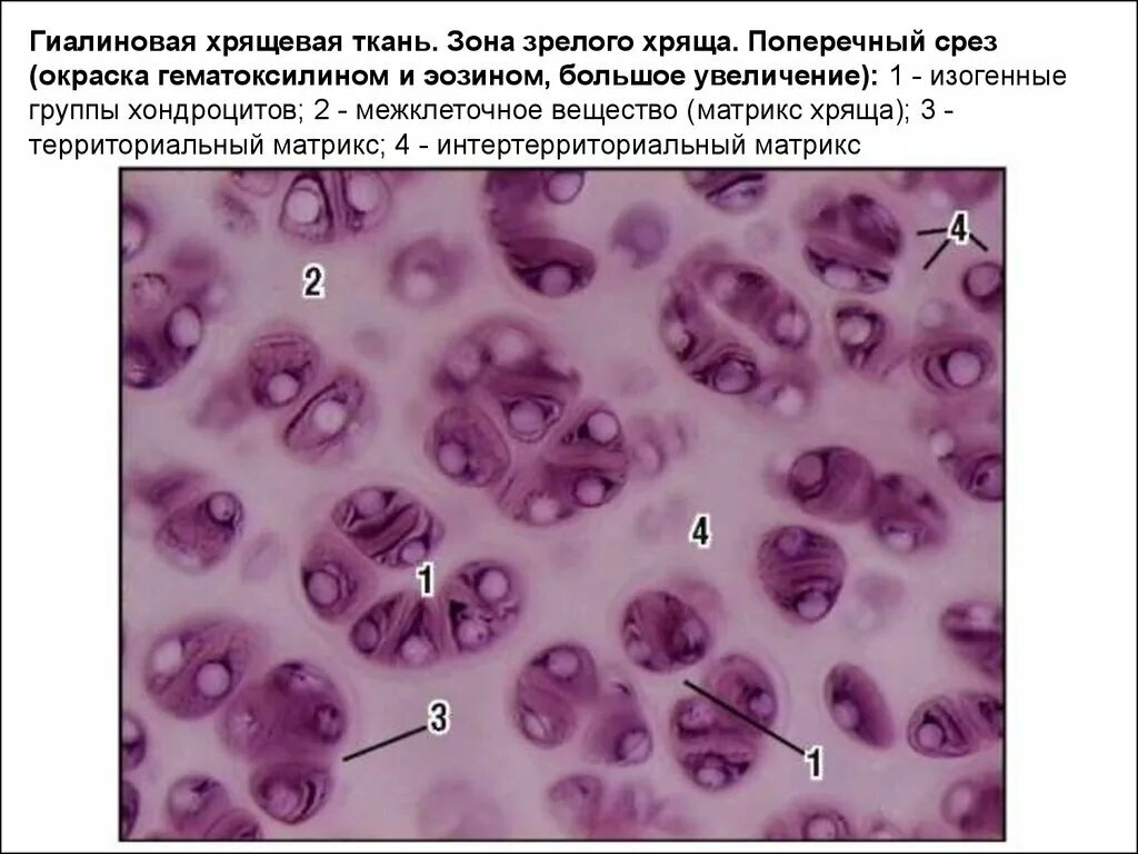 Изогенные группы. Гиалиновый хрящ территориальный Матрикс. Гиалиновая хрящевая ткань гистология. Соединительная ткань гиалиновый хрящ. Межклеточное вещество гиалинового хряща препарат.