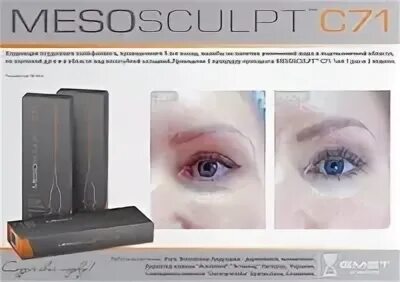 Мезоскульпт с 71. MESOSCULPT c71. MESOSCULPT c71 до и после. Мезоскульпт мужчине.