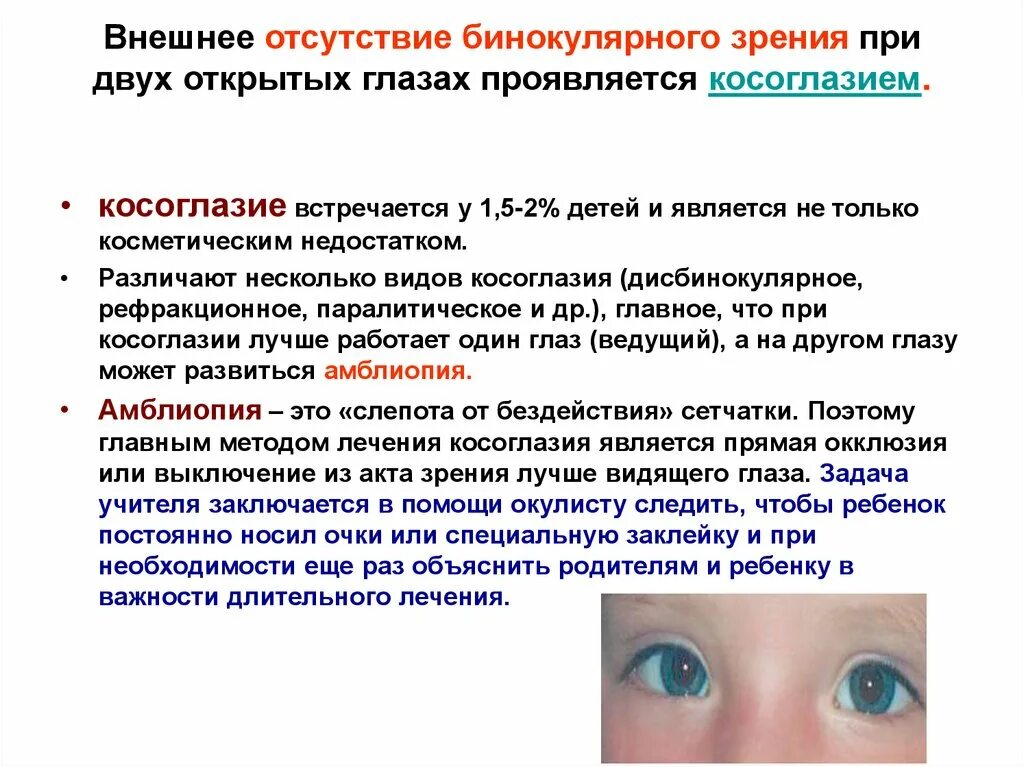 Методы исследования при косоглазии. Методы исследования при косоглазии у детей. Отсутствие бинокулярного зрения. Косоглазие зрение.