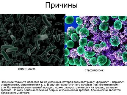 Стрептококк это вирус или бактерия