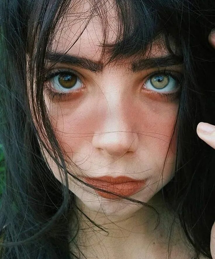 Гарри поттер гетерохромия. Металлозная гетерохромия. Центральная гетерохромия зеленый карий. Секторная гетерохромия глаза. Центральная гетерохромия зрачок.