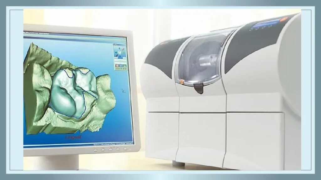 Cad cam системы. Церек кад кам. 3d протезирование cerec. технология cerec в стоматологии. cad cam технологии в ортопедической стоматологии.