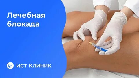 Лечебная блокада отзывы