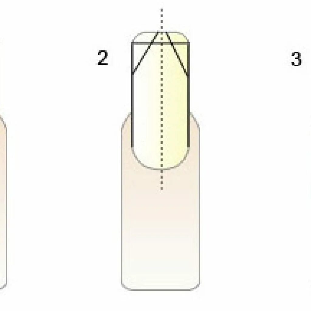 Как выпилить форму ногтей. Форма ногтей квадрат опил формы. Схема правильного опила форм ногтей. Схема опила миндальных ногтей. Опил формы схема.