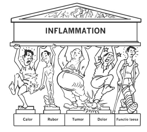Признак воспаления dolor. Признаки воспаления 5 признаков. Пять признаков воспаления на латыни. Признаки воспаления на латинском. Симптомы воспаления на латыни.