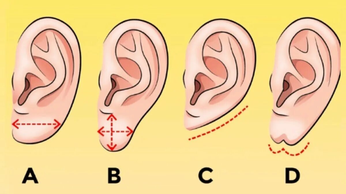 Почему уши разные. Характер по мочке ушей.