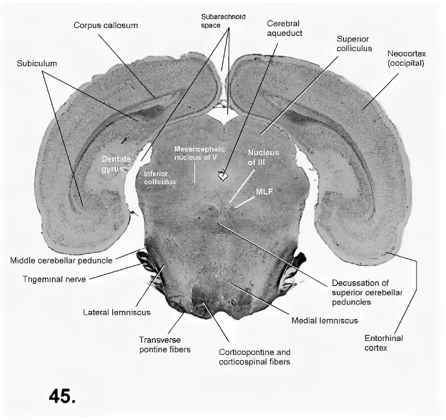 Colliculus superior