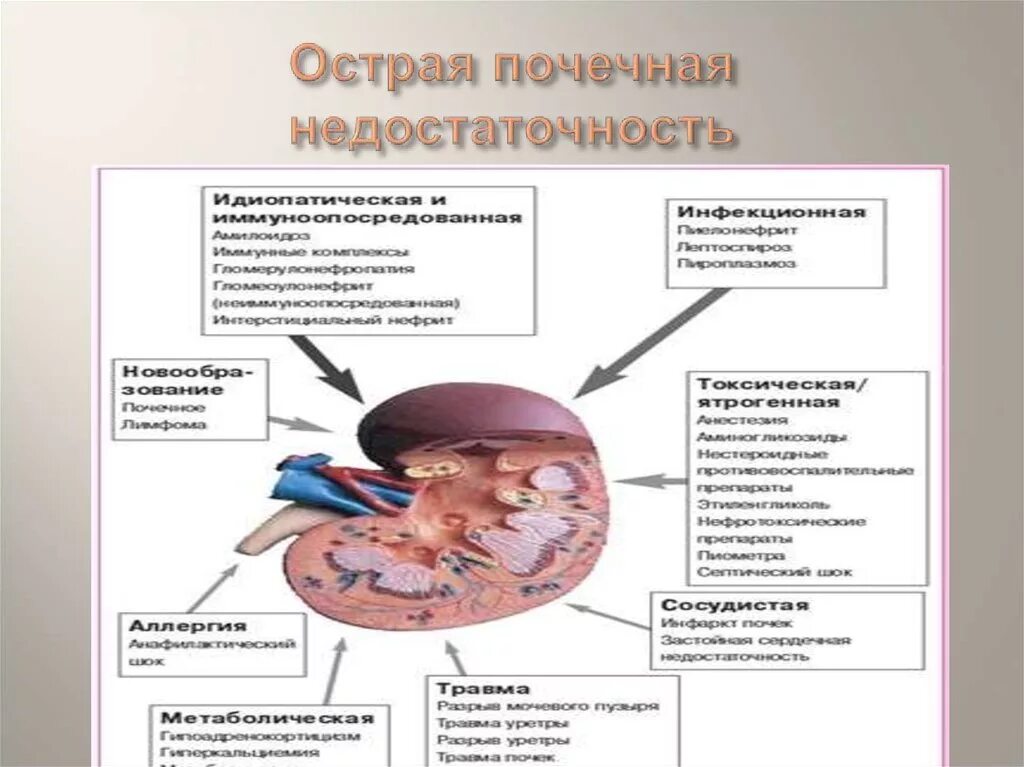 Отделение опн. Острая токсическая почечная недостаточность. Почечной недостаточности ОПН. УЗИ при острой почечной недостаточности. Ренальная острая почечная недостаточность.