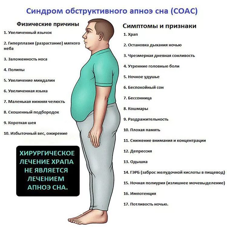 Почему происходит остановка. Синдром обструктивного апноэ. Синдром обструктивного апноэ сна. Синдром обструктивного апноэ сна симптомы. Синдром обструктивного ночного апноэ.