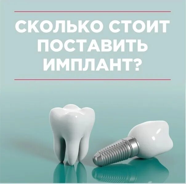 Сколько будет стоить импланты