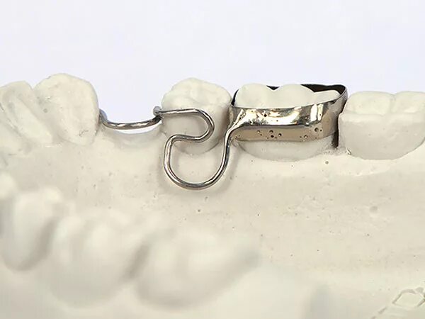 Fagga ортодонтический аппарат. держатель места для молочных. кольцо с распоркой ортодонтия. держатель места в ортодонтии. расширитель межзубный.