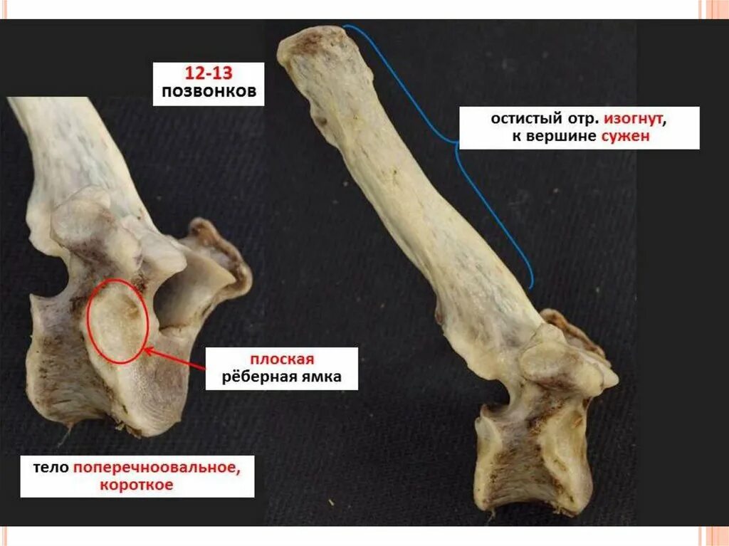 Особенности позвоночника собаки. Строение грудного позвонка лошади. Грудной позвонок лошади анатомия. Грудные позвонки животного анатомия. Грудной позвонок собаки анатомия.