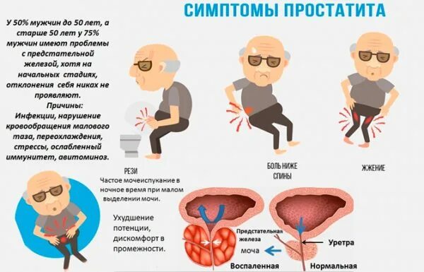 Признаки простатита у мужчин после 60