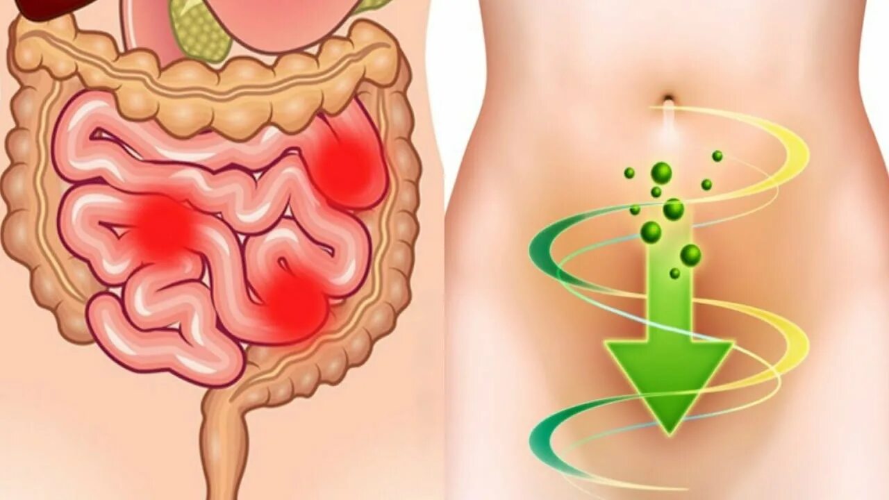 Как очистить кишечник от газов. Для улучшения пищеварения.