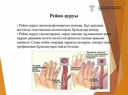 Транни еркектің есегіне тығып алды.