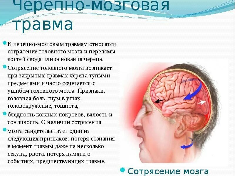 Удар головы затылком. Симптоматика сотрясения головного мозга обуславливается. Три основных признака при сотрясении головного мозга.. Черепно мозговая травма ушиб мозга. Сеоепно мозгоапя Травиа.