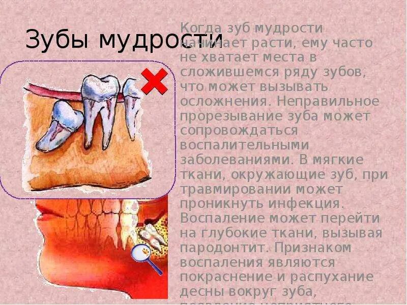 Прорезается зуб мудрости. Зуб мудрости проростается. Сколько зубов мудрости может быть у человека