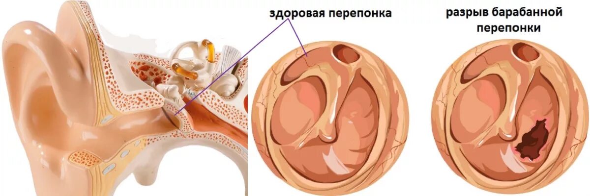 Тубоотит сколько длится