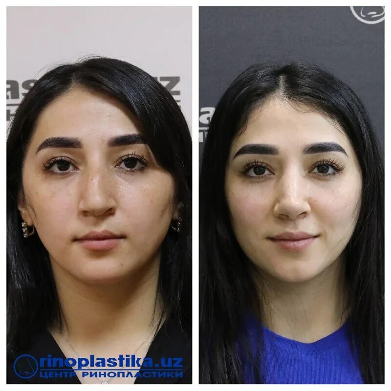 центр ринопластики