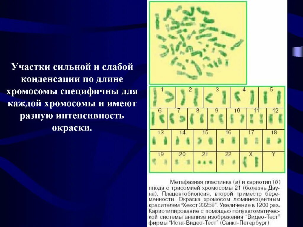 Цитогенетический метод окрашивание хромосом. Цитогенетический метод презентация. Кариотипирование (цитогенетическое исследование)?. Конденсация хромосом. Цитогенетический метод наследственные заболевания