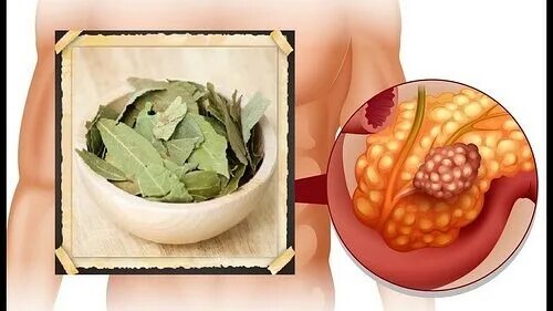 травяной сбор для чистки печени. чистка печени и поджелудочной. как лечить поджелудочную. поджелудочная и желчный пузырь. лекарственные препараты для поджелудочной железы и печени.