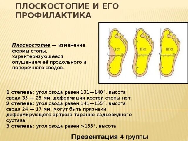 Плоскостопие у детей врач. Плоскостопие высота свода стопы. Профилактика плоскостопия. Профилактика выявления плоскостопия. Плоскостопие профилактика плоскостопия.