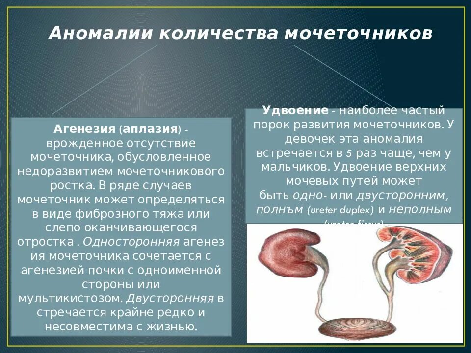 Аномалия мочевого. Причины пороки развития мочевыделительной системы. Аномалии структуры мочеточников. Врожденные аномалии мочеточников. Аномалии развития почек.