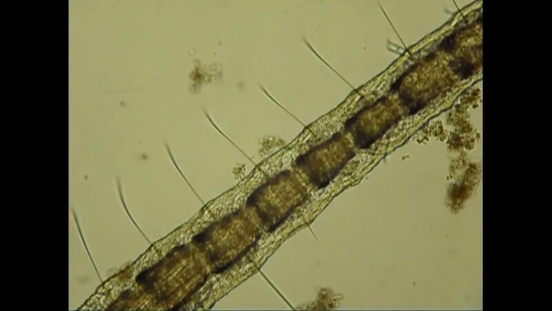 Активный червь. Малощетинковые черви активного ила. Aelosoma Малощетинковые черви. Черви в активном иле. Червячки в активном иле.