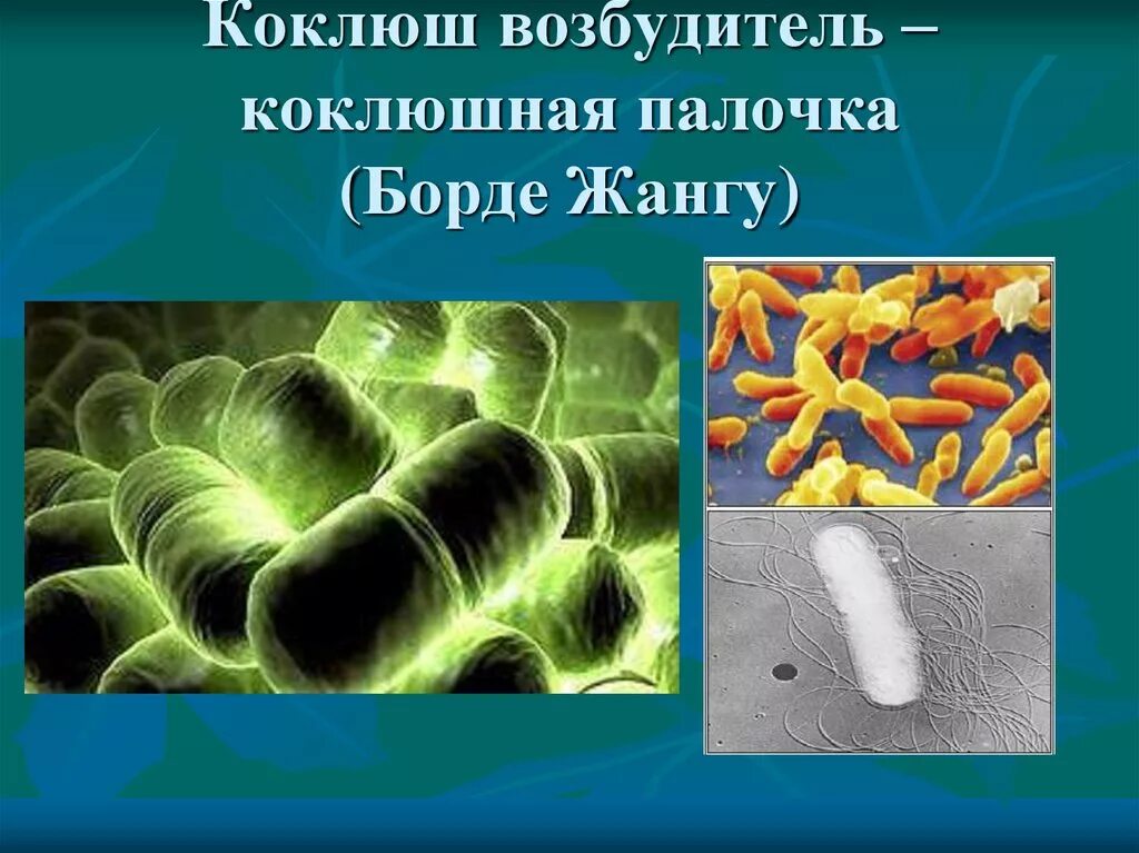 Коклюш бактериальная. Бактерия возбудитель коклюша. Коклюшная палочка борде-Жангу. Коклюш и паракоклюш возбудитель. Бактерия борде-Жангу.