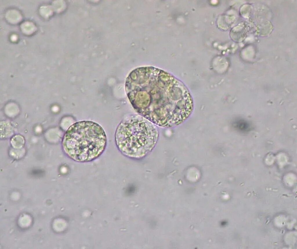 Высокие бактерии в моче. Лейкоциты в моче микроскопия. Микроскопия осадка мочи лейкоциты. Микроскопия мочи бактерии. Почечный эпителий.