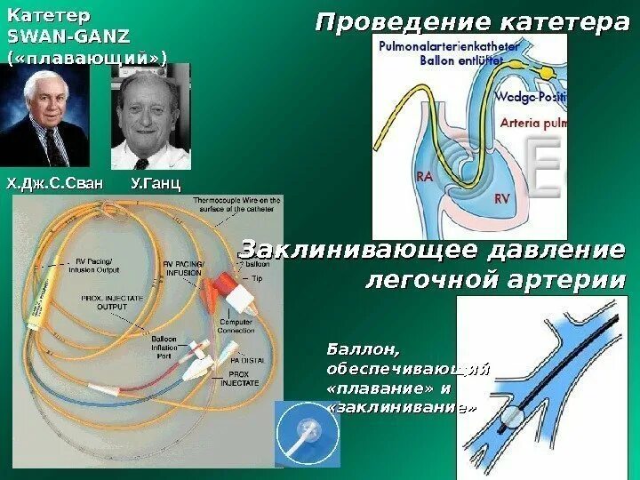 Как измерить давление в легочной артерии. Как измерить давление в легочной артерии