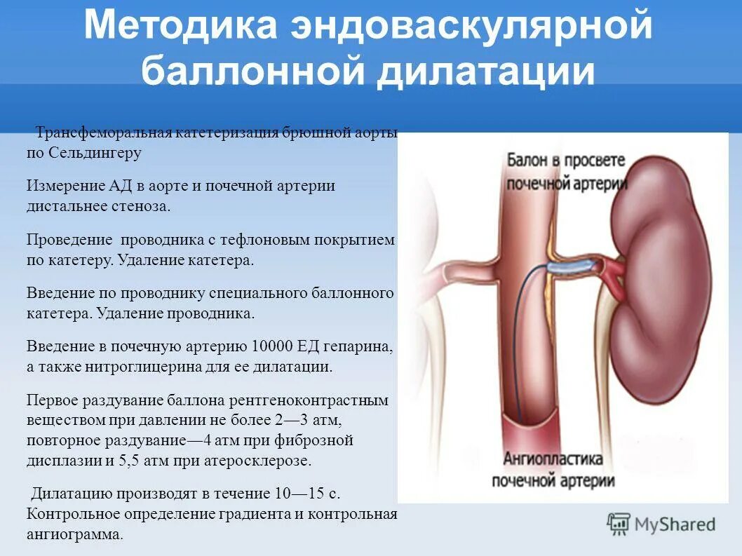 Измерение аорты. Измерение аорты. Диаметр восходящего отдела аорты. Парастернальная позиция по длинной оси на эхокг. Пульсация в яремной ямке.