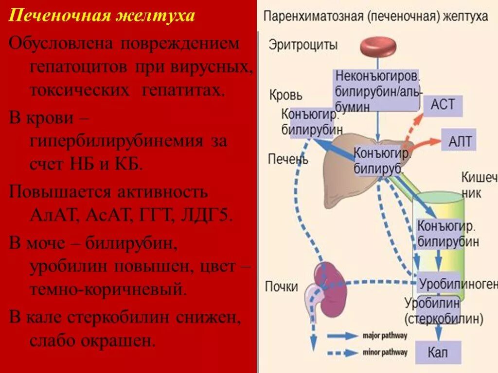 Фракции билирубина при желтухах. Печеночная желтуха биохимия. паренхиматозная желтуха схема обмена билирубина. обмен билирубина при паренхиматозной желтухе схема. обмен билирубина при печеночной желтухе схема.