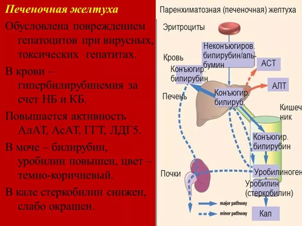 Повышен белок в печени. Печеночная желтуха биохимия. Паренхиматозная желтуха схема обмена билирубина. Схема обмена билирубина при паренхиматозной желтухе. Обмен билирубина при печеночной желтухе схема.