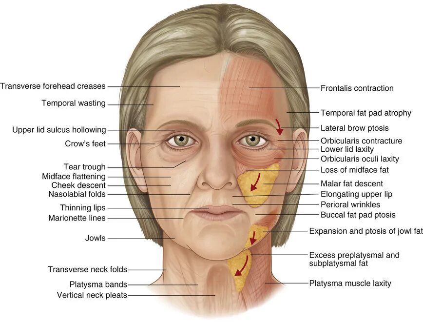 Ptosis латынь