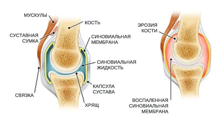 Между суставами