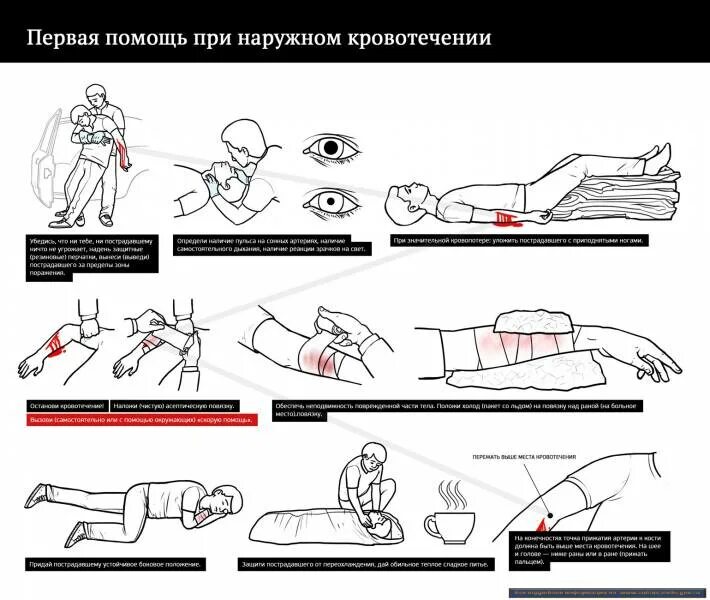 Этапы оказания первой помощи при наружных кровотечениях. ПМП при наружных кровотечениях. Алгоритм оказания первой помощи при наружном кровотечении. Хтапы первой помощи при наруном кровотечение.